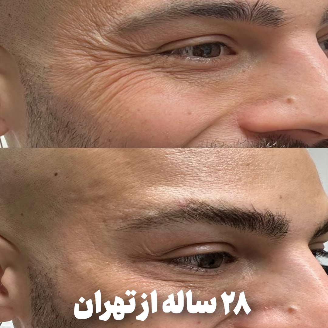 کرم جوانساز و رفع چین و چروک اسپرولینا اصلی (پرداخت در 4 قسط)