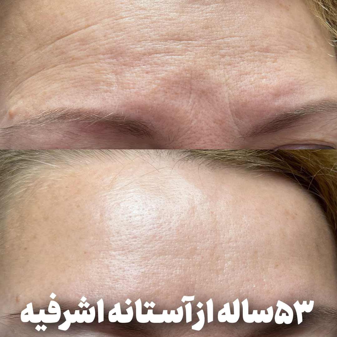 کرم جوانساز و رفع چین و چروک اسپرولینا اصلی (پرداخت در 4 قسط)