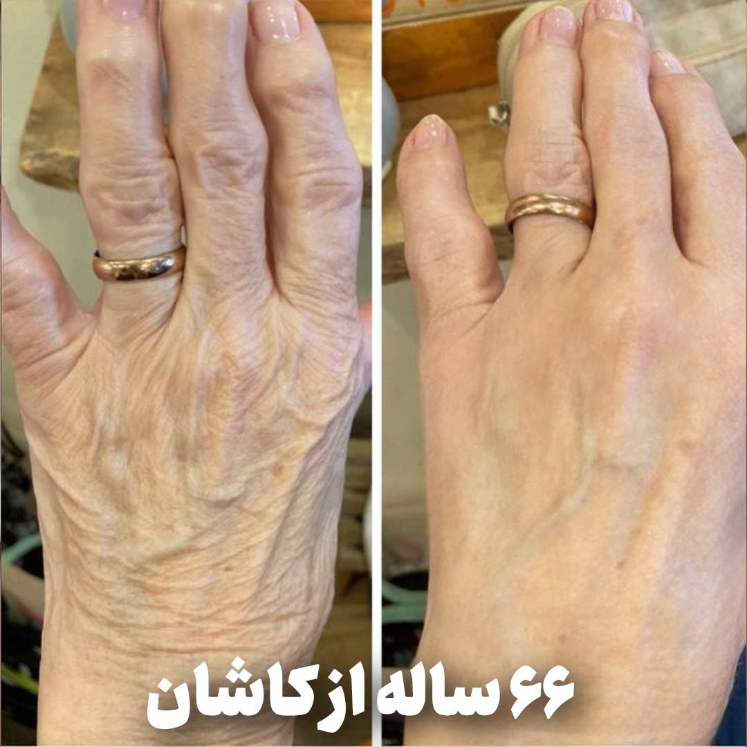 کرم جوانساز و رفع چین و چروک اسپرولینا اصلی (پرداخت در 4 قسط)