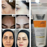 کرم بیوممتیک لکه بردار قوی بارکد دار اصلی