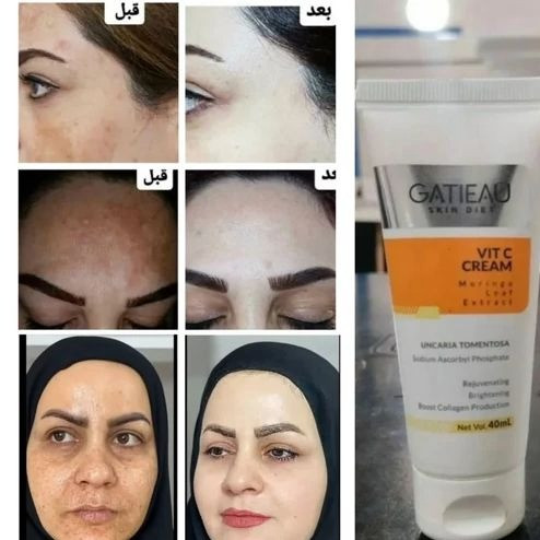کرم بیوممتیک لکه بردار قوی بارکد دار اصلی