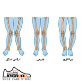 کفی ارتوپدی طبی تخصصی مناسب کف پای صاف و زانوی ضربدری ( سایز 23 تا 45 )