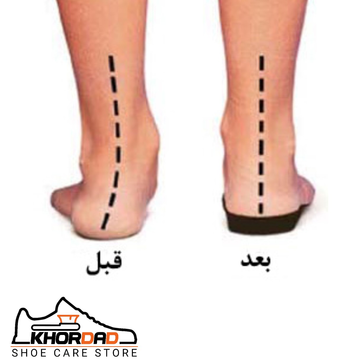 کفی ارتوپدی طبی تخصصی مناسب کف پای صاف و زانوی ضربدری ( سایز 23 تا 45 )
