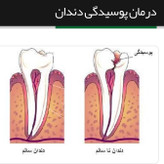 5بسته نخ کتان دندان ریحان 6متر و نیم