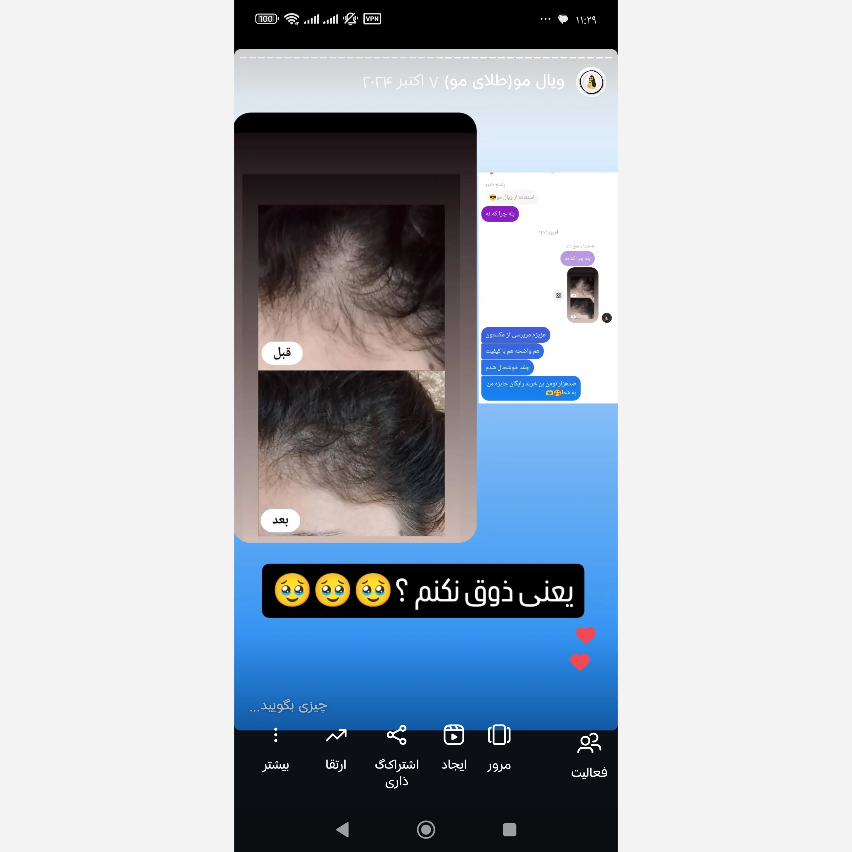ویال مو(تقویت و رشد مجدد مو)کاملا گیاهی و فاقد ماینوکسیدیل