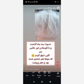 ویال مو(تقویت و رشد مجدد مو)کاملا گیاهی و فاقد ماینوکسیدیل