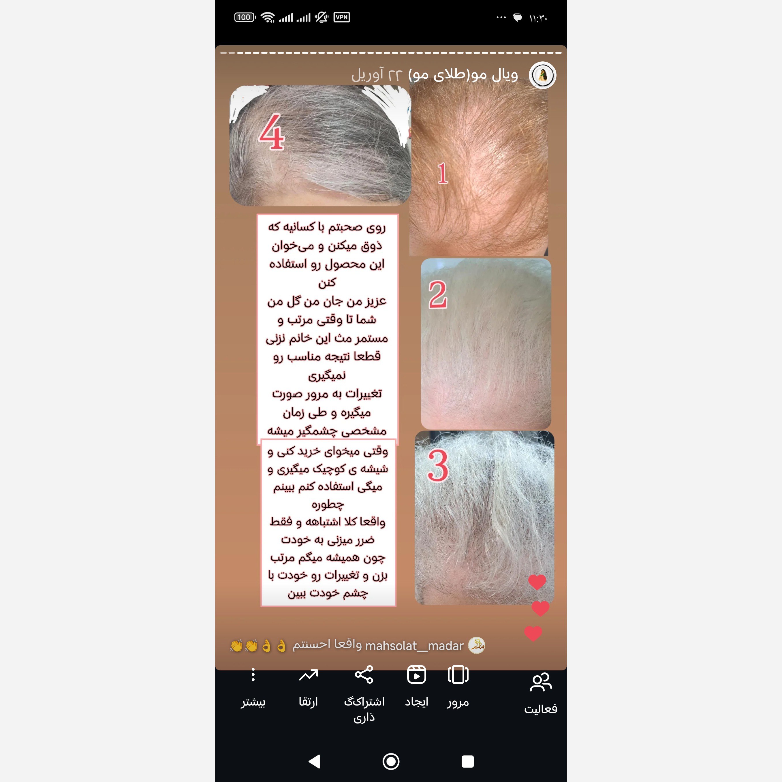 ویال مو(تقویت و رشد مجدد مو)کاملا گیاهی و فاقد ماینوکسیدیل