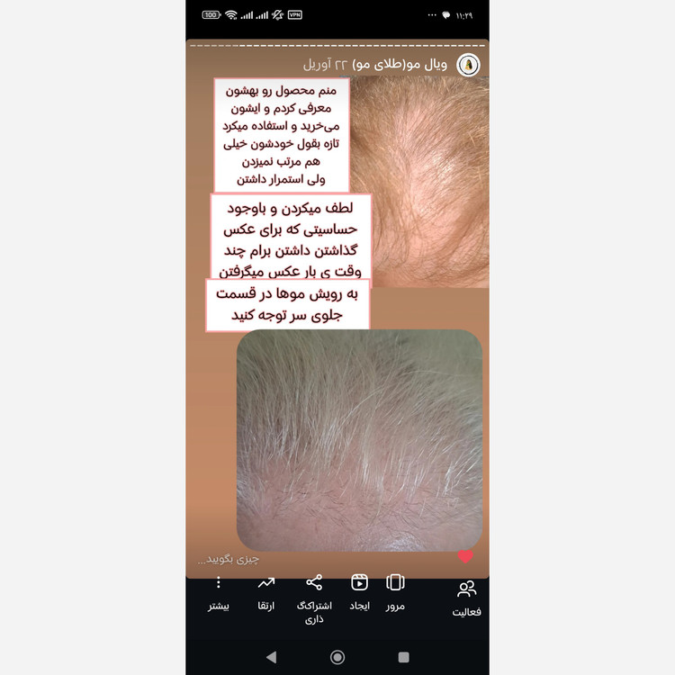 ویال مو(تقویت و رشد مجدد مو)کاملا گیاهی و فاقد ماینوکسیدیل