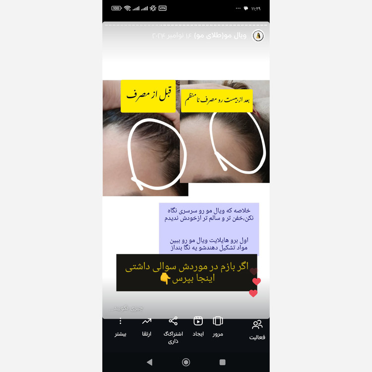 ویال مو(تقویت و رشد مجدد مو)کاملا گیاهی و فاقد ماینوکسیدیل