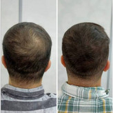 سرم مو تضمینی پرپشت کننده قوی الگا هیربوست Olga hair boost رشد مجدد ضدریزش مو