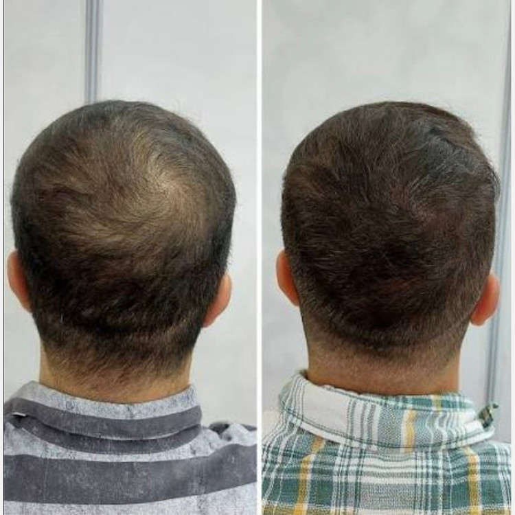 سرم مو تضمینی پرپشت کننده قوی الگا هیربوست Olga hair boost رشد مجدد ضدریزش مو