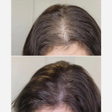سرم مو تضمینی پرپشت کننده قوی الگا هیربوست Olga hair boost رشد مجدد ضدریزش مو