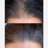 سرم مو تضمینی پرپشت کننده قوی الگا هیربوست Olga hair boost رشد مجدد ضدریزش مو