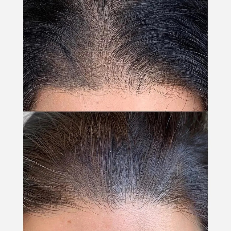 سرم مو تضمینی پرپشت کننده قوی الگا هیربوست Olga hair boost رشد مجدد ضدریزش مو